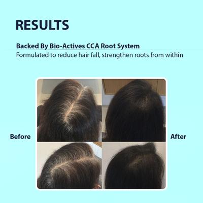 Dermistry Anti Hair Fall With Caffeine Collagen Arginine Shampoo 200 ml - Shampoos
