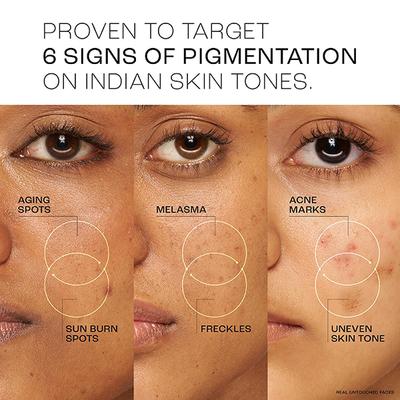 Lakme Perfect Radiance Serum 15 ml - Essences