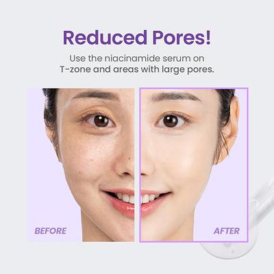 Tirtir Niacinamide 20% Serum Advanced 30 ml - Face Serum