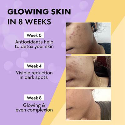 Chicnutrix Glow - Japanese Glutathione and Vit C Skin Brightening - Black Current - 20 Tablets 1's - Multi-Vitamins