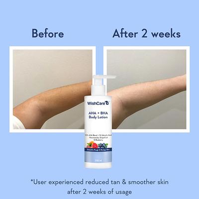WishCare 10% AHA + 1% BHA Body Lotion - Smooths Rough & Bumpy Skin - With NiacinamiderapeFruit & Blueberry 200 ml - Lotions & Creams