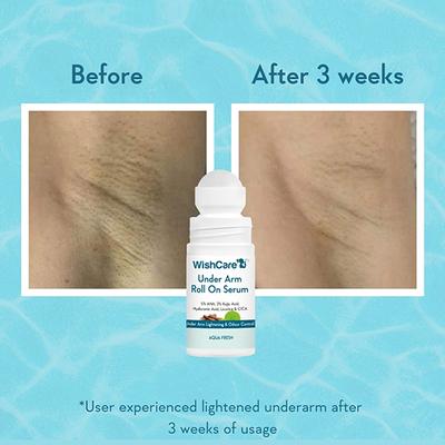 WishCare Under Arm Roll On Serum - 5% AHA, 3% Kojic Acid - Aqua Fresh 50 ml - Deodorants/Roll-Ons