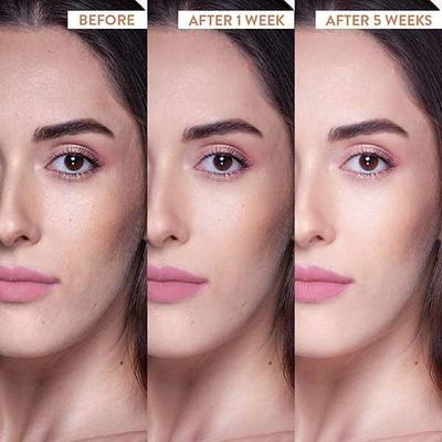 Belora French Merlot Gold Moisturizer 50 gm - Face Moisturizers