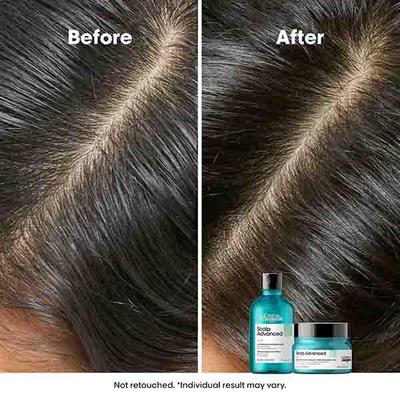 L'Oreal Professionnel Scalp Advanced Anti-Oiliness Dermo-Purifier Shampoo 300 ml - Shampoos