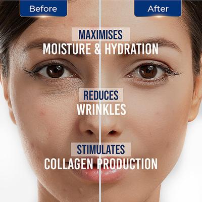 St.Botanica HA-Hyaluronic Acid Professional Facial Serum 20 ml - Dark Circle & Wrinkle Busters