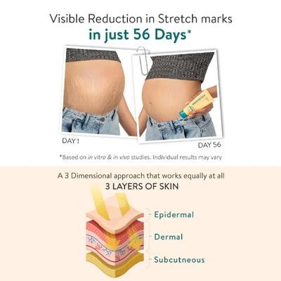 Inostretch Intensive Scar and Anti Stretch Mark Cream 60 gm - Skin-Treatment