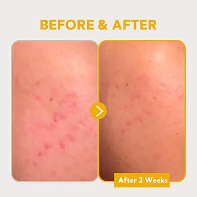 Tirtir Pure Vitamin C24 Serum 30 ml - Face Serum