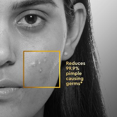 VLCC Clinic Acne Spot Relief 30 ml - Face Gels