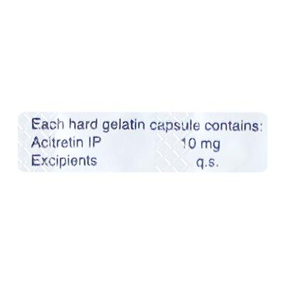 Actoid 10mg Capsule 10'S - Psoriasis/Seborrhea/Ichthyosis-Pso