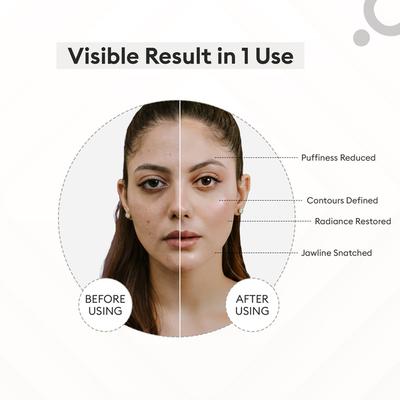 Protouch Glow Pro - Microcurrent Facial Toning Device - Etoupe 1's - Massagers