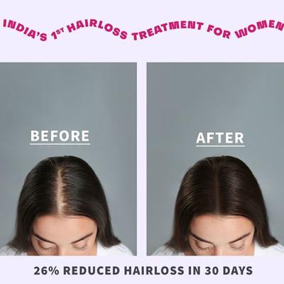 Anveya Roots Ban The Fall Hair Oil-In Serum 120 ml - Hair Serums