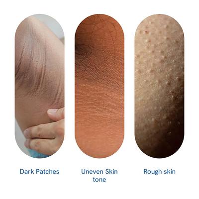 Be Bodywise Pigmentation Repair Cream 100 gm - Lotions & Creams