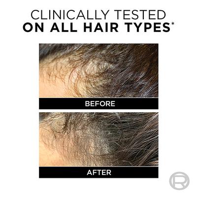 L'Oreal Paris Fall Resist 3X Anti Hairfall Shampoo with Arginine Essence 650ml - Shampoos