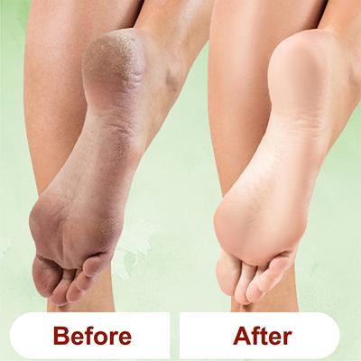 Kazarmaa Lemon Grass Foot Scrub And Foot Scrubber Tool 250 gm - Foot Scrubs