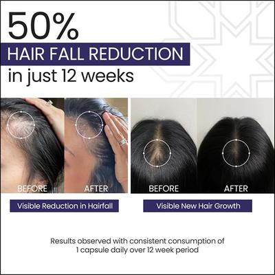 NOVEGROW NUTRI NUTRACEUTICAL Tablet 10's - Hair Loss-Oda