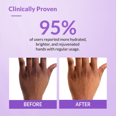 Fixderma Hand Cream for Women and Men, Hand Cream for Dry and Rough Hands All Skins Types 30 gm - Night Cream