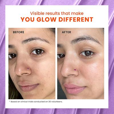 Foxtale The Stunner Skin Radiance Mask Cleans Pores & Reduces Blackheads Improve Skin Clarity & Tone 75gm - Masks & Peels