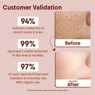 Aravi Organic Pure Vitamin E Oil Best Oil 30 ml - Face Oils