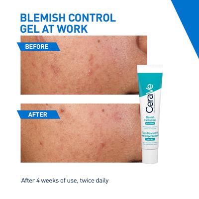 CeraVe Blemish Control Gel 40 ml - Face Creams