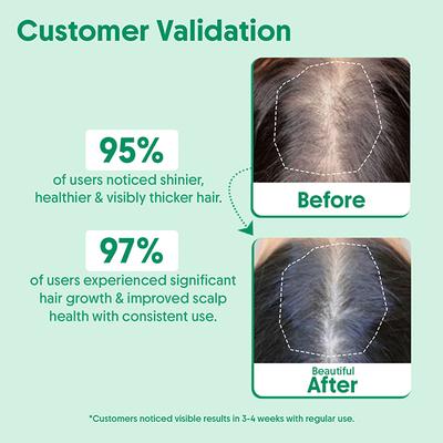 Aravi Organic 100% Pure Natural Rosemary Essential Oil For Hair Growth and Nourish Skin 100 ml - Essential Oils