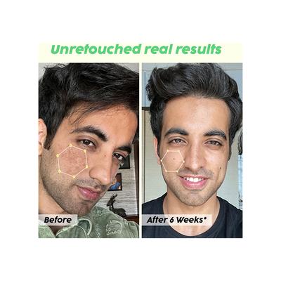 Plix The Plant Fix 2% Salicylic Acid Jamun Active Acne Control Dewy Serum 30 ml - Face Serum