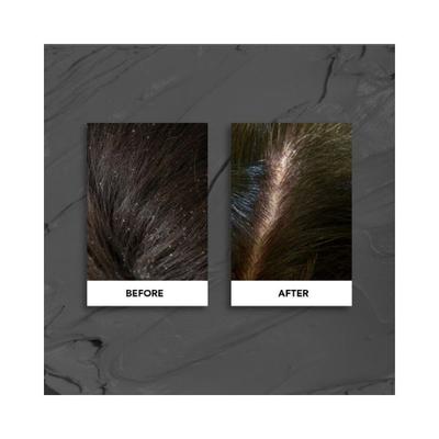 Flawsome Scalp Scrub + Deep Cleansing Hair Mask 2 In 1 200 gm - Hair Masks & Packs