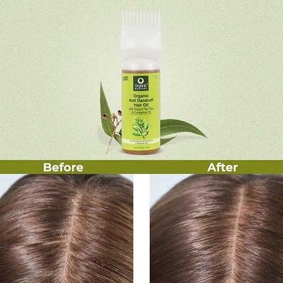Organic Harvest Anti Dandruff Hair Oil Apple & Tea Tree 150 ml - Hair Oils