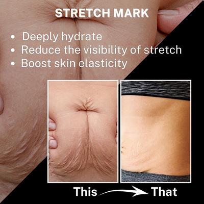 House of Beauty Stretchmark Oil 50 ml - Essential Oils