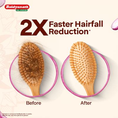 Baidyanath Red Onion Hair Oil 200 ml - Speciality Medicines