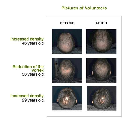 Soulflower Rosemary Redensyl Hair Growth Serum 30 ml - Hair Serums