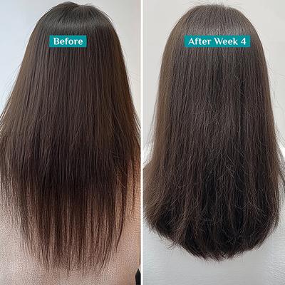 Pilgrim Redensyl and Anagain Hairfall Control Shampoo 200 ml - Shampoos