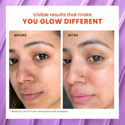 Foxtale The Stunner Skin Radiance Mask Cleans Pores & Reduces Blackheads Improve Skin Clarity & Tone 75gm - Masks & Peels