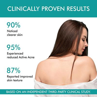 The Love Co. Bacne Warrior Acne Fighting Body Spray - With 02% Salicylic Acid + Niacinamide + Cucumber + Aloevera 100 ml - Creams, Lotions & Oils