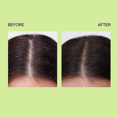 Quench Dandruff Control Scalp Scrub with Tea Tree Extracts 200 ml - Hair Masks & Packs