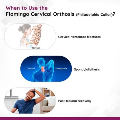 Flamingo Cervical Orthosis (OC - 2009) (S) - Back/Abdomen Supports