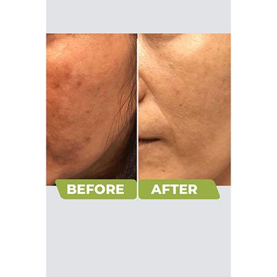 Organic Harvest Sunscreen - SPF 60 (All Skin) 50gm - Body Sunscreen