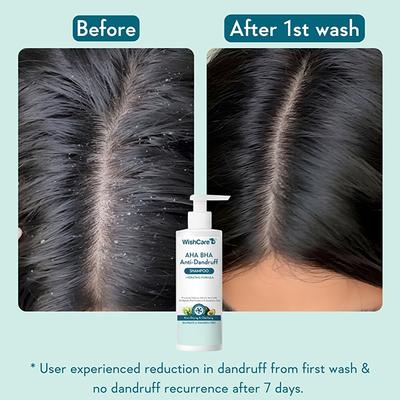 Wishcare Hydrating AHA BHA Anti Dandruff Shampoo -Piroctone Olamine, Salicylic Acid, LHA, Probiotics 250 ml - Eyeshadow, Bases & Primers