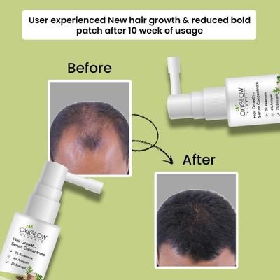 OxyGlow Herbals Hair Growth Serum Concentrate 30 ml - Hair Serums
