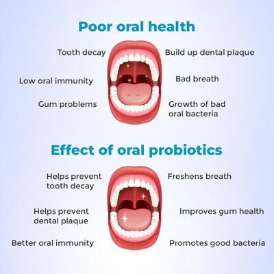 Healthyr-U Oral Health Sugar Free Cinnamon Flavour Probiotic Chewable Tablet 60's - Digestive Health