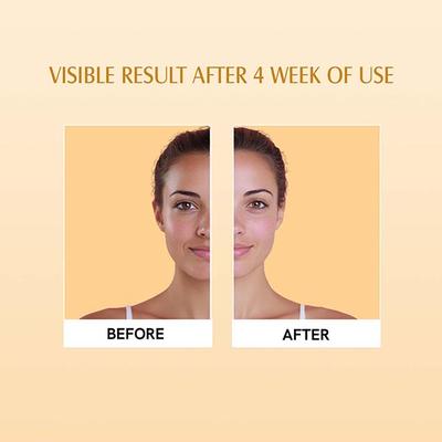 Aravi Organic Spf 50 Pa++++ Sunscreen Stick Uva-B Radiation With Lightweight and Natural Finish 13 gm - Body Sunscreen