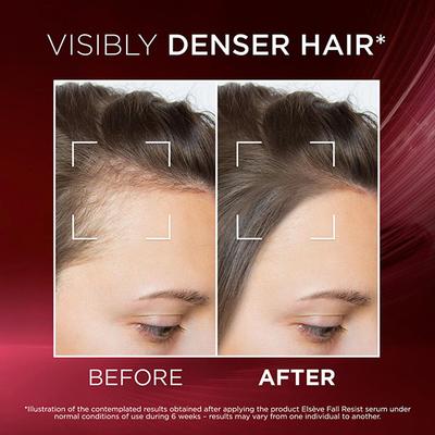 L'Oreal Paris Fall Resist Anti Hair Fall Serum with 1.5% Aminexil, for Lesser Visible Scalp 102 ml - Hair Serums