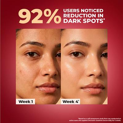 Chicnutrix Outshine Face Serum - Glowing Skin 30 ml - Face Serum