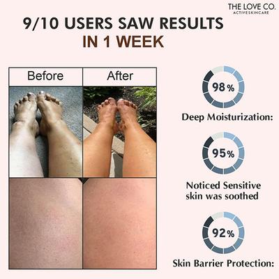 The Love Co. Japanese Cherry Blossom Body Yogurt - 72 Hour Intense Hydrating Shea Body Butter - Deep Moisturization for Winters With Pure Shea Butter for Nourishing Essential Body Care 200 gm - Body Butter