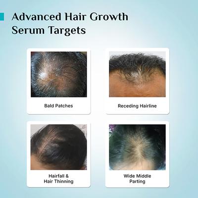 Pilgrim Redensyl & Anagain Advanced Hair Growth Serum 50 ml - Hair Serums