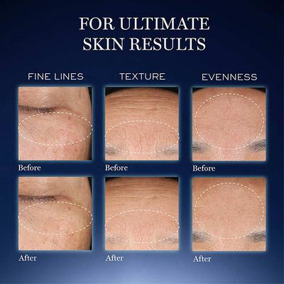 Lancome Genifique Ultimate Repair Starter Kit 1's - Face Serum