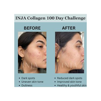 INJA Fit Marine Collagen Powder - Coffee Flavour 250 gm - Hair & Skin