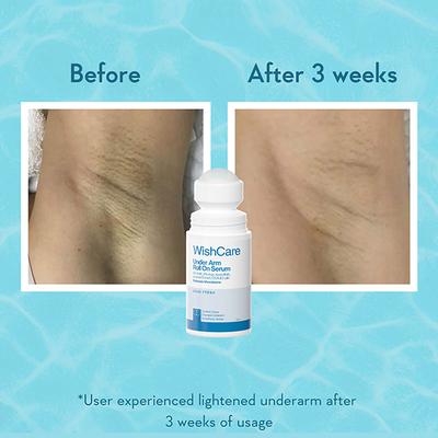 Wishcare Aqua Fresh Underarm Roll On Serum - Reduces Pigmentation & Prevents Body Odour (50ml) - Deodorants/Roll-Ons