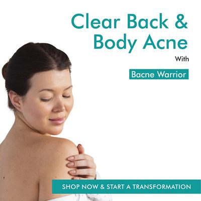 The Love Co. Bacne Warrior Acne Fighting Body Spray - With 02% Salicylic Acid + Niacinamide + Cucumber + Aloevera 100 ml - Creams, Lotions & Oils