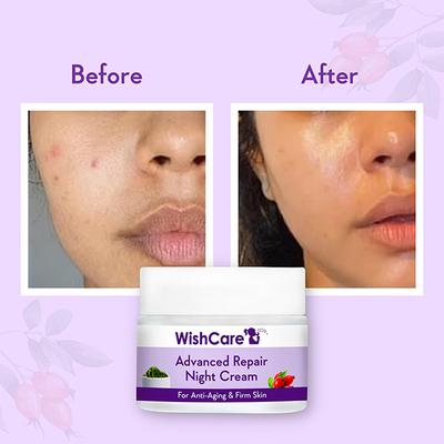 WishCare Advanced Repair Night Cream - Anti-Ageing Cream -With Retinol GrapeSeed SeaAlgae & Rosehip 50 gm - Night Cream