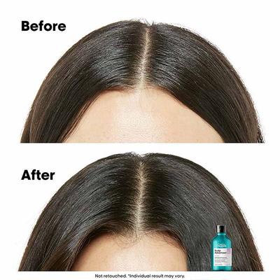 L'Oreal Professionnel Scalp Advanced Anti-Discomfort Dermo-Regulator Shampoo 300 ml - Shampoos